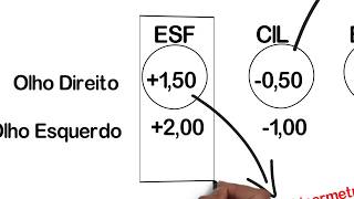 Entenda sua Receita Oftalmológica [upl. by Jasper]