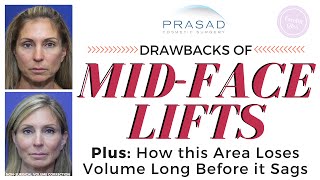 Drawbacks of MidFace Lifts and How the MidFace Loses Volume Before it Sags [upl. by Ellainad]