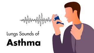 Asthma Patient Using Accessory Muscles For Breathing [upl. by Delaine926]