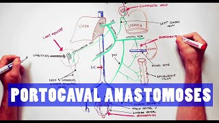 Portocaval Anastomoses  ANATOMY Tutorial [upl. by Boulanger]