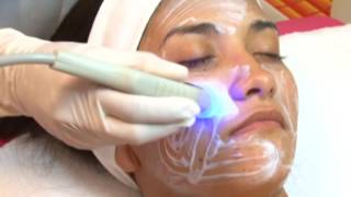 Radiofrecuencia Facial o Lifting sin cirugía [upl. by Pet]