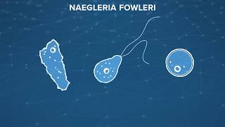 Naegleria Fowleri the braineating amoeba What is it How do you prevent it [upl. by Odranar979]