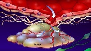 Introduction to Cancer Biology Part 4 Angiogenesis [upl. by Mallin]