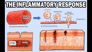 THE INFLAMMATORY RESPONSE [upl. by Zelig]