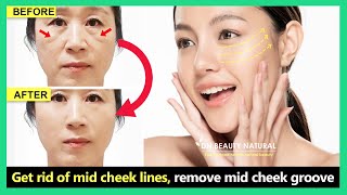 Mid Face Lift  Get rid of mid cheek lines remove midface wrinkles with Face exercise amp massage [upl. by Rheta]