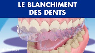 Blanchiment dentaire © [upl. by Ardelle]