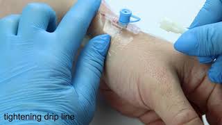 How to start IV drip Step by step tutorial from nurse [upl. by Cousins]