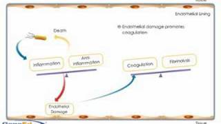 Sepsis development and progression [upl. by Shalne]