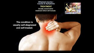 Whiplash Injuries Causes amp Symptoms  Everything You Need To Know  Dr Nabil Ebraheim [upl. by Eelsha]