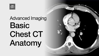 Advanced Imaging Basic Chest CT Anatomy [upl. by Maxentia]