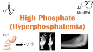 High Phosphate Hyperphosphatemia Dietary Sources Causes Symptoms Treatment [upl. by Htiekal]