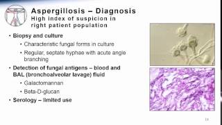 Aspergillosis [upl. by Dira]