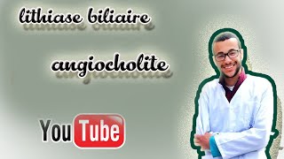 lithiase biliaire  cholécystite  LVBP  angiocholite [upl. by Enylodnewg]