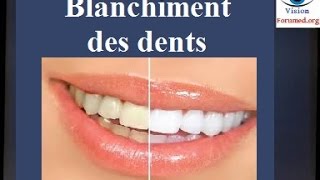 Blanchiment des dents techniques [upl. by Fante]