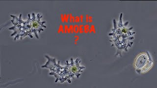 What is Amoeba [upl. by Ynohtnacram231]