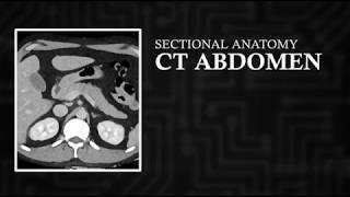 CT Cross Sectional Anatomy Abdomen Axial View [upl. by Cicenia815]