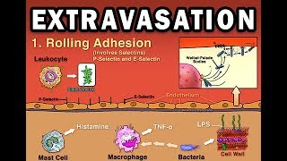 EXTRAVASATION [upl. by Eisenberg]