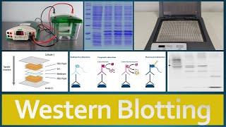 Western Blotting  Principle Procedure and Applications [upl. by Josepha807]