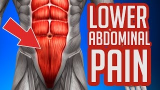 Lower Abdominal Pain  Common Causes amp Symptoms [upl. by Nnylhsa701]