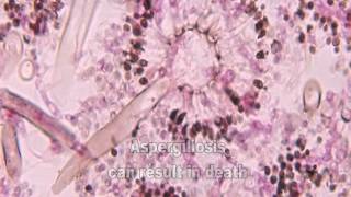 Aspergillus and Aspergillosis [upl. by Tfat915]