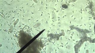 Protists Amoeba Euglena Paramecium [upl. by Imij]