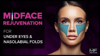 Under Eye and Midface Rejuvenation with Dermal Fillers at Mabrie Facial Institute [upl. by Lanoil798]