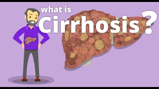 Cirrhosis  What is cirrhosis [upl. by Elman]