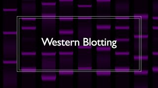 Western Blot Protocol Overview [upl. by Normie]