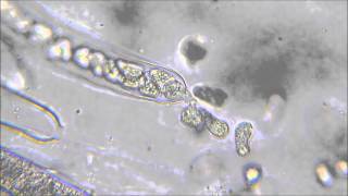 Oomycota zoospores being released from sporangia [upl. by Yahiya]