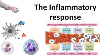 The Inflammatory response [upl. by Hymen]