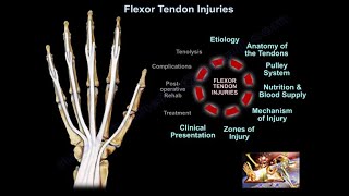 Flexor Tendon Injuries  Everything You Need To Know  Dr Nabil Ebraheim [upl. by Land]