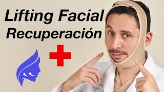 Lifting facial recuperación [upl. by Adolpho]