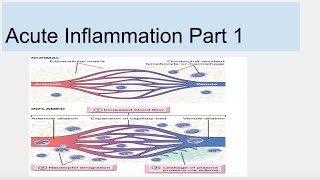 Acute Inflammation Part 1 [upl. by Llerihs140]