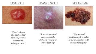 Dermatology on USMLECOMLEX [upl. by Atinaj]