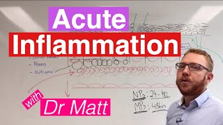 Acute Inflammation  Immunology [upl. by Aciraa46]