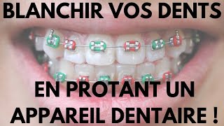 Comment Blanchir Vos Dents en Portant Un Appareil Dentaire [upl. by Mojgan]