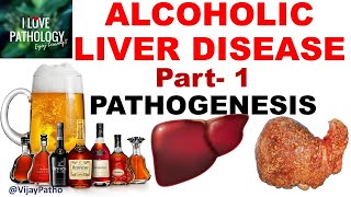 ALCOHOLIC LIVER DISEASE Part 1 Pathogenesis [upl. by Edithe676]