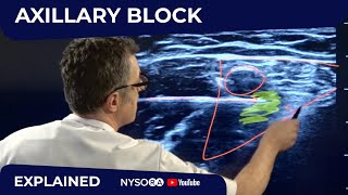 Axillary Brachial Plexus Block  Regional anesthesia Crash course with Dr Hadzic [upl. by Eixor]