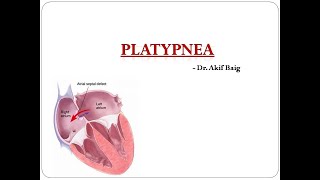 Platypnea Dr Akif Baig [upl. by Negiam]