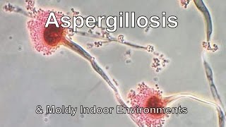 Aspergillosis amp Moldy Indoor Environments [upl. by Cash959]